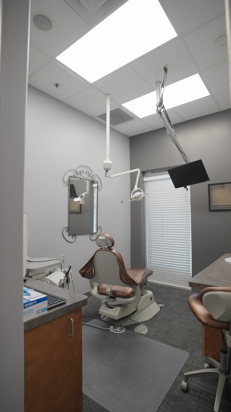 No-prep veneers